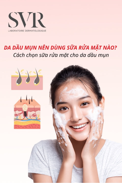 Da dầu mụn nên dùng sữa rửa mặt nào? Cách chọn sữa rửa mặt cho da dầu mụn