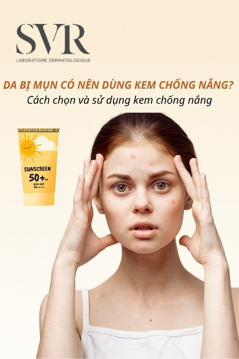 Da bị mụn có nên dùng kem chống nắng? Cách chọn và sử dụng kem chống nắng cho da mụn