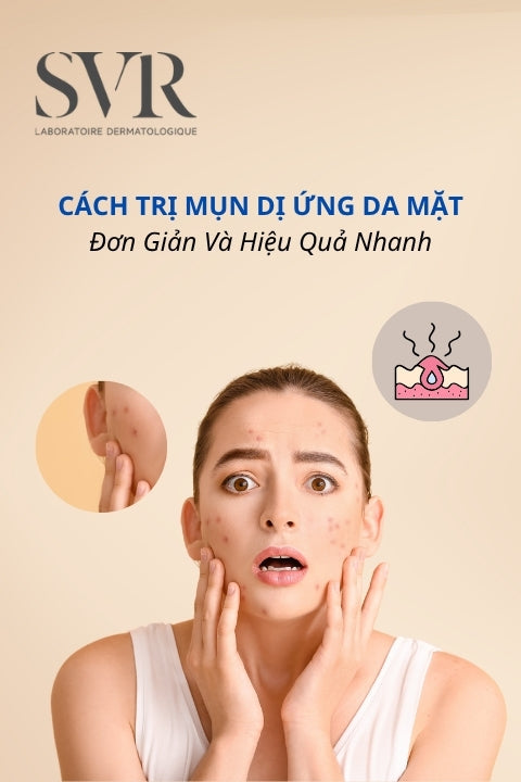 cách trị mụn dị ứng da mặt