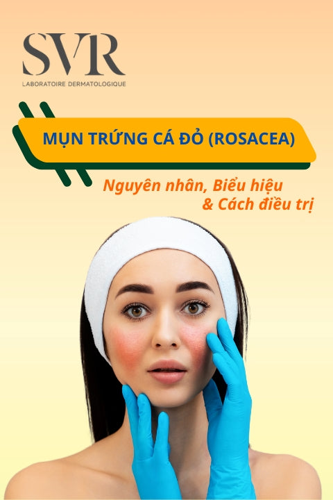 mụn trứng cá đỏ