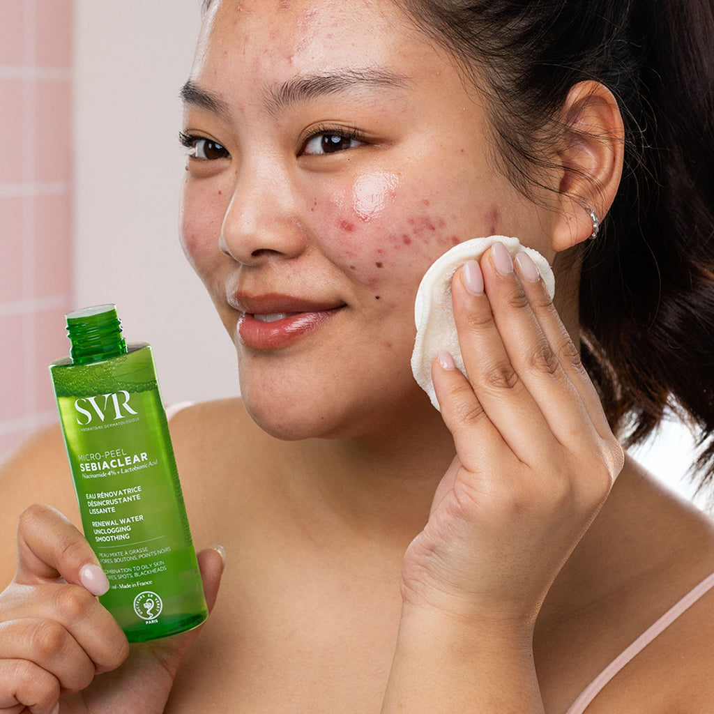 Nước cân bằng giảm mụn 150ml