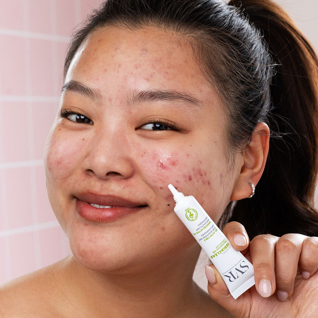 Kem Chấm Mụn SVR Sebiaclear Cicapeel Dạng Gel 15ML