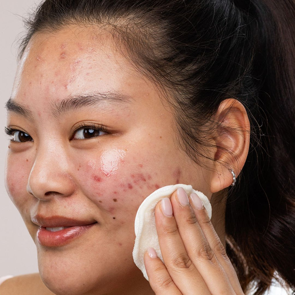 Nước Tẩy Trang Kiềm Dầu SVR Sebiaclear Eau Micellaire