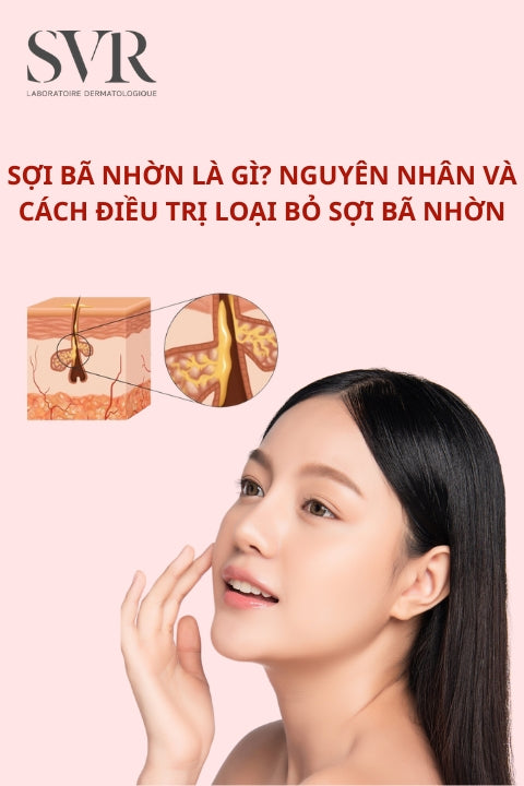 Sợi bã nhờn là gì? Nguyên nhân và cách điều trị loại bỏ sợi bã nhờn