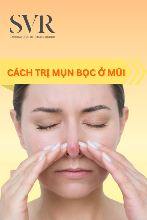 cách trị mụn bọc ở mũi