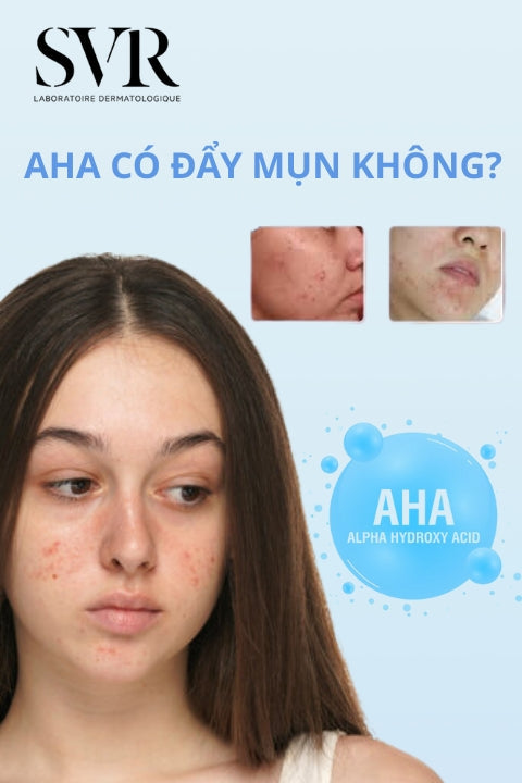 AHA có đẩy mụn không