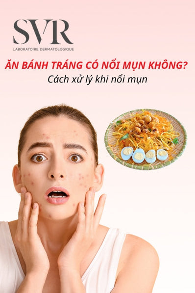 Ăn bánh tráng trộn, bánh tráng nướng có nổi mụn không?