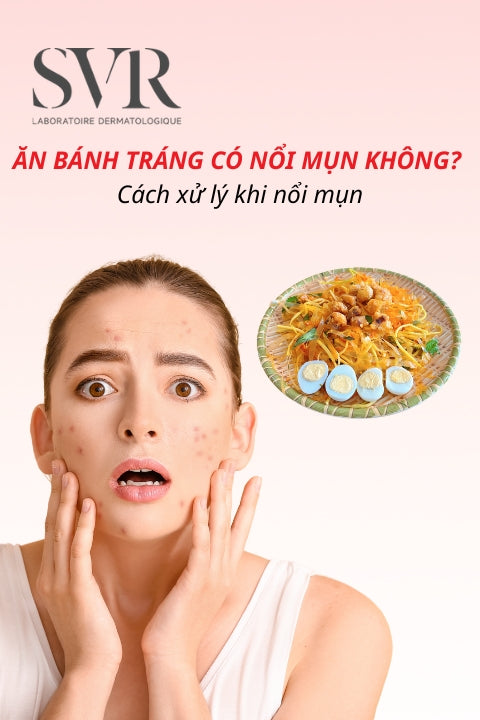 Ăn bánh tráng có nổi mụn không? Cách xử lý khi nổi mụn