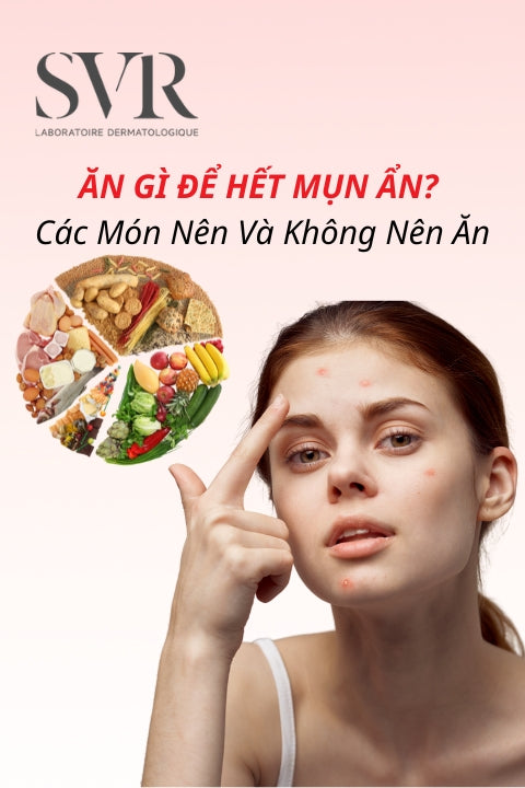 Ăn gì để hết mụn ẩn? Những món nên và không nên ăn giảm mụn, đẹp da