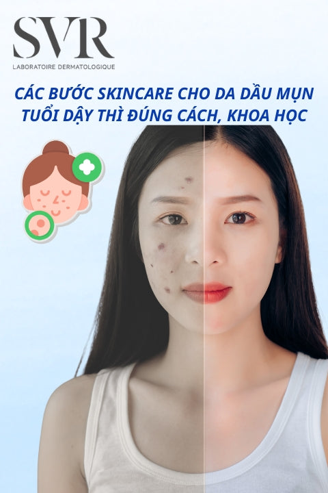 Các bước skincare cho da dầu mụn tuổi dậy thì đúng cách, khoa học