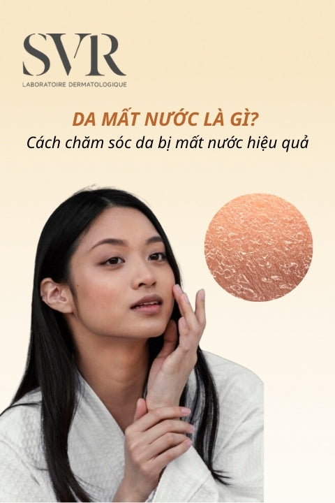 Da mất nước là gì? Cách chăm sóc da bị mất nước hiệu quả