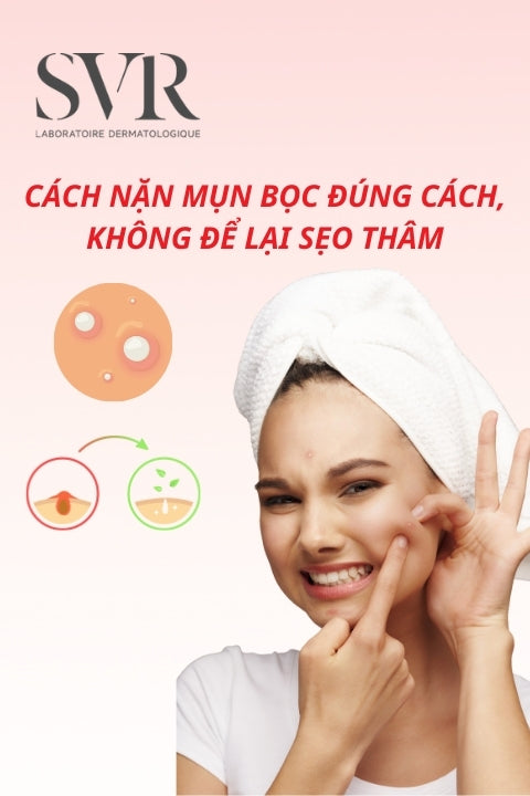 Cách nặn mụn bọc đúng cách, không để lại sẹo thâm