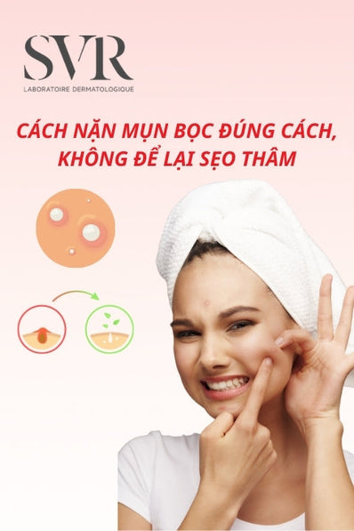 Cách nặn mụn bọc đúng cách, không để lại sẹo thâm