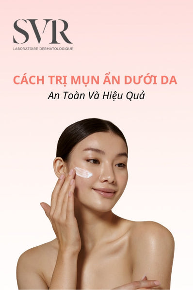 15 Cách trị mụn ẩn dưới da hiệu quả, được bác sĩ da liễu khuyên dùng