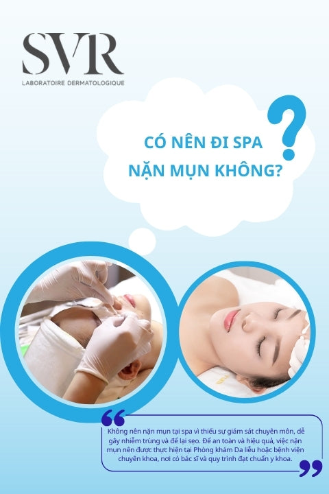 Có nên đi spa nặn mụn không?