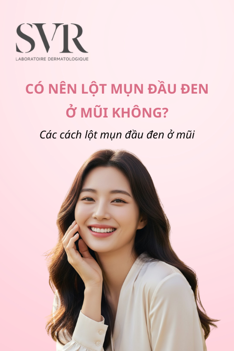 có nên lột mụn đầu đen không?