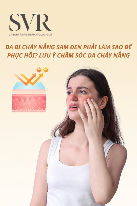 Da bị cháy nắng sạm đen phải làm sao để phục hồi? Lưu ý chăm sóc da cháy nắng