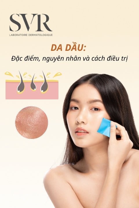 Da dầu: Đặc điểm, nguyên nhân và cách điều trị đúng chuẩn tại nhà