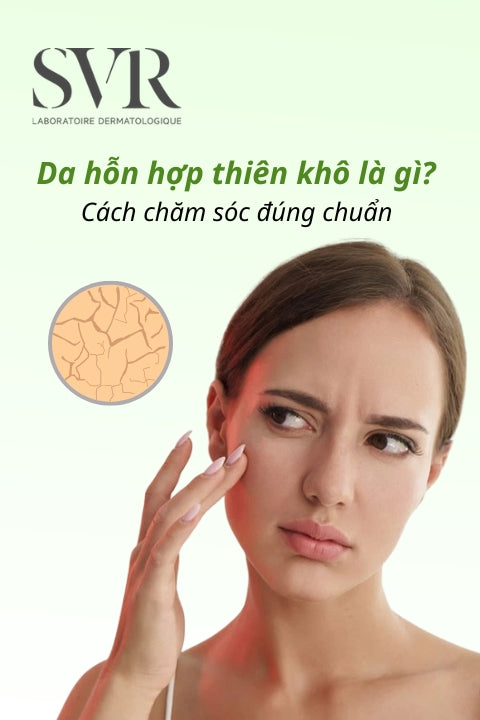 Da hỗn hợp thiên khô là gì? Cách chăm sóc da hỗn hợp thiên khô đúng chuẩn