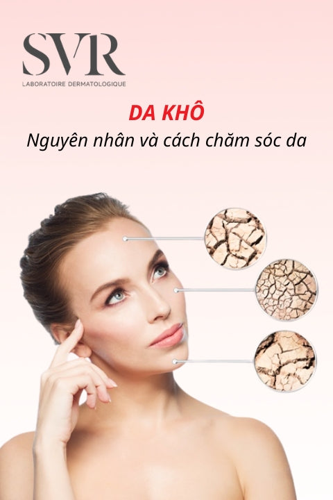 Da khô: Nguyên nhân và cách chăm sóc da khô đúng cách, hiệu quả tại nhà