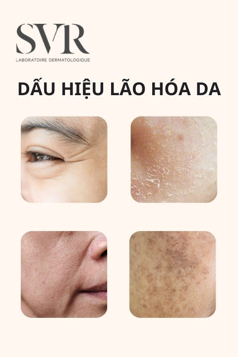 12 dấu hiệu lão hóa da thường gặp và cách nhận biết sớm