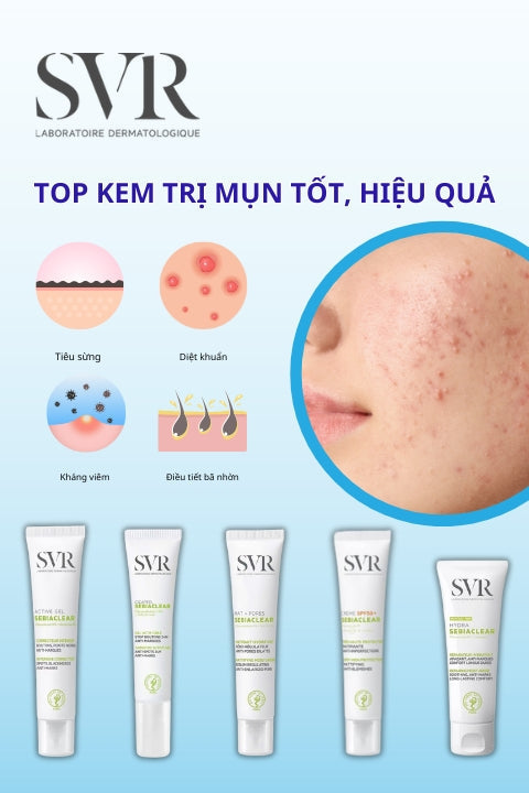 Top kem trị mụn tốt