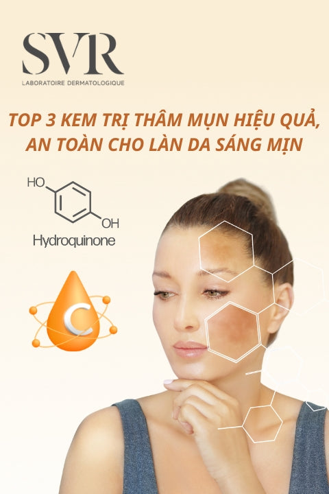 Top 3 kem trị thâm mụn hiệu quả, an toàn cho làn da sáng mịn