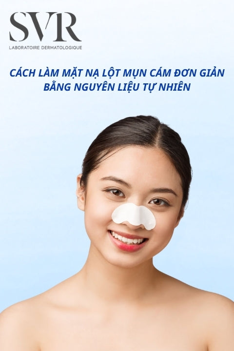 Cách làm mặt nạ lột mụn cám đơn giản tại nhà bằng nguyên liệu tự nhiên