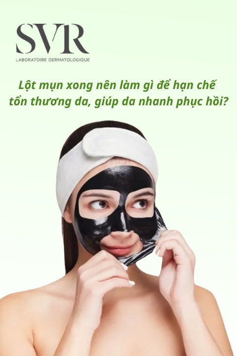 Lột mụn xong nên làm gì để tránh tổn thương da, giúp da nhanh phục hồi?