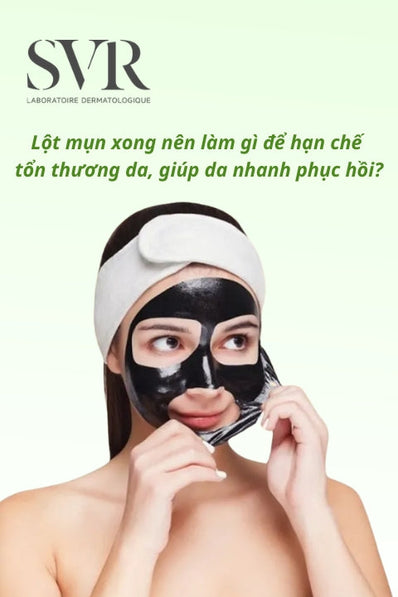 Lột mụn xong nên làm gì để tránh tổn thương da, giúp da nhanh phục hồi?