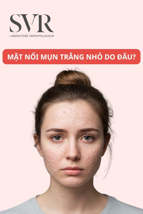 mặt nổi mụn trắng nhỏ