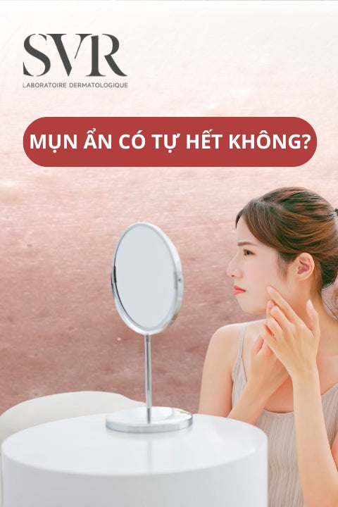 mụn ẩn có tự hết không