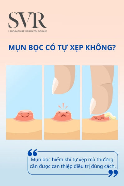 Mụn bọc có tự xẹp không?