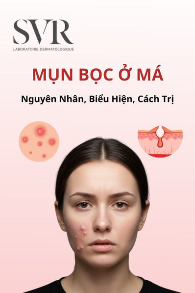 mụn bọc ở má