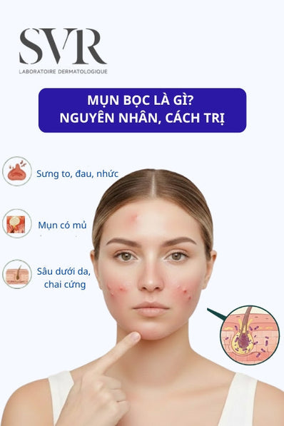 Mụn bọc là gì?