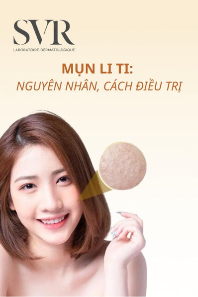 mụn li ti