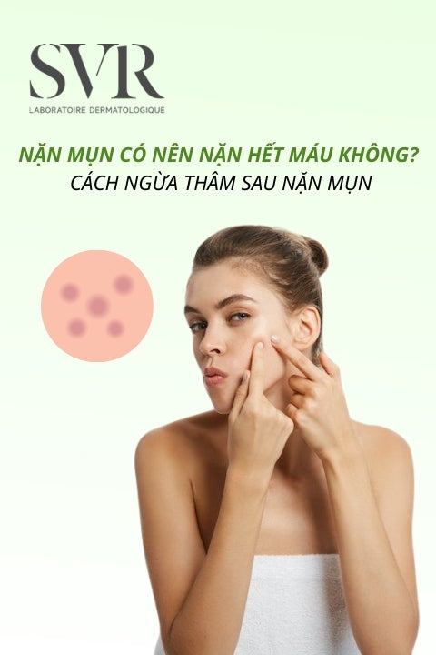Nặn mụn có nên nặn hết máu không? Cách ngừa thâm sau nặn mụn