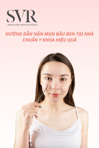Có nên nặn mụn đầu đen không? Cách nặn mụn tại nhà chuẩn y khoa