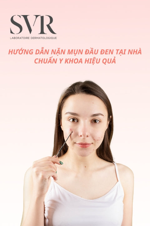 Hướng dẫn nặn mụn đầu đen tại nhà chuẩn y khoa hiệu quả