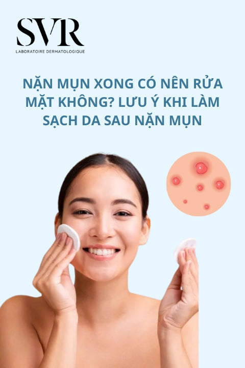 Nặn mụn xong có nên rửa mặt không? Lưu ý khi làm sạch da sau nặn mụn