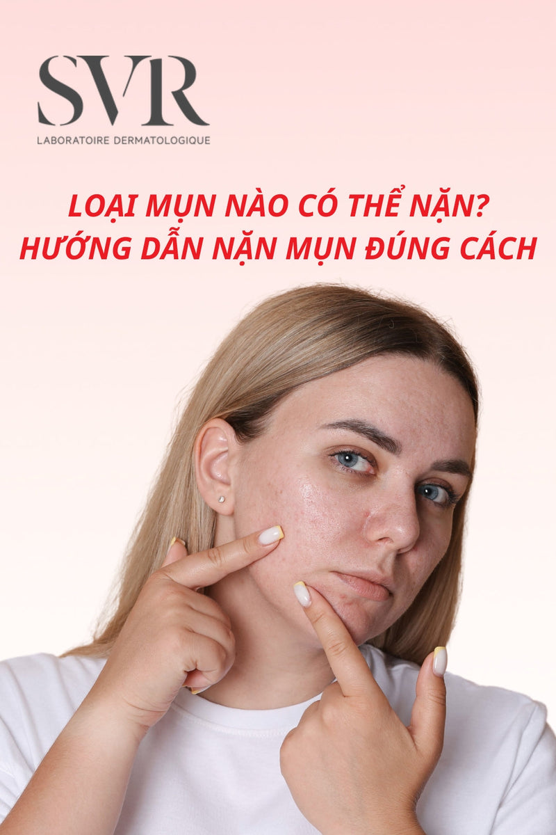 Loại mụn nào có thể nặn? Hướng dẫn nặn mụn đúng cách, không để lại thâm sẹo
