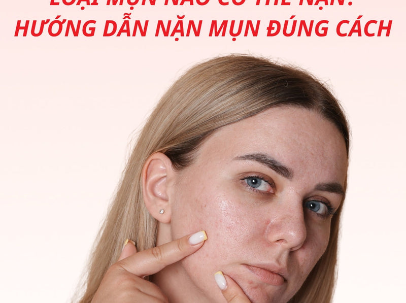Loại mụn nào có thể nặn? Hướng dẫn nặn mụn đúng cách, không để lại thâm sẹo