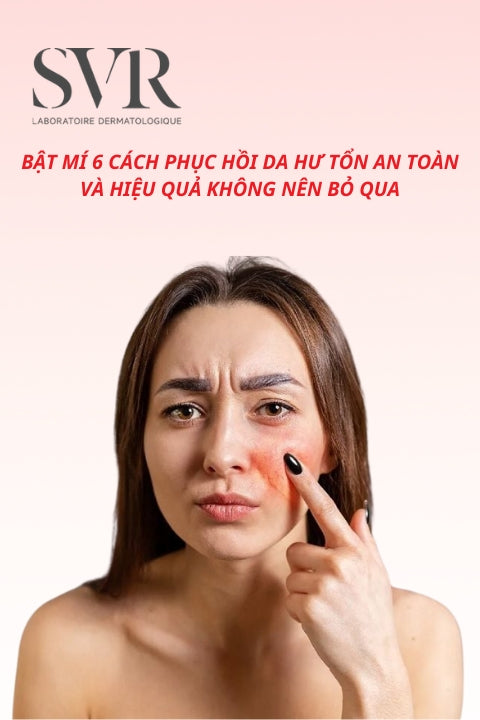 Bật mí 6 cách phục hồi da hư tổn an toàn và hiệu quả không nên bỏ qua