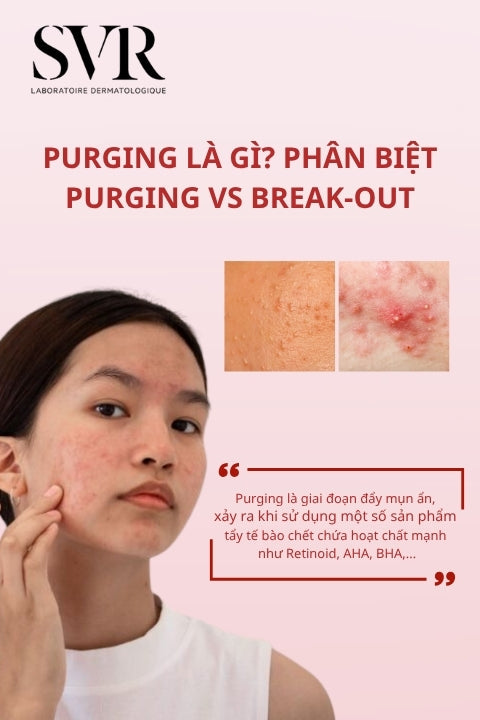 Purging mụn là gì