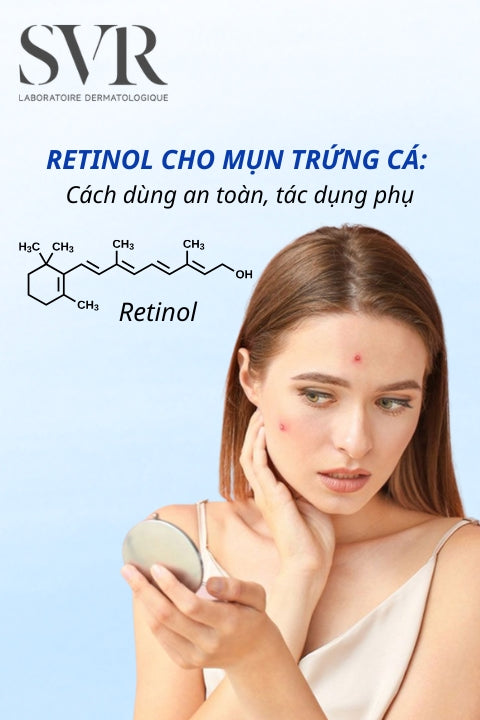 Retinol cho mụn trứng cá: Cách dùng an toàn, tác dụng phụ