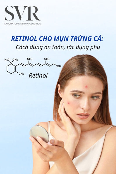 Retinol cho mụn trứng cá: Cách dùng an toàn, tác dụng phụ