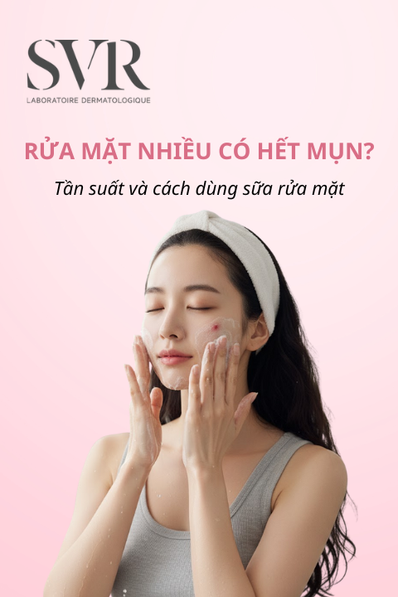 rửa mặt nhiều có hết mụn không