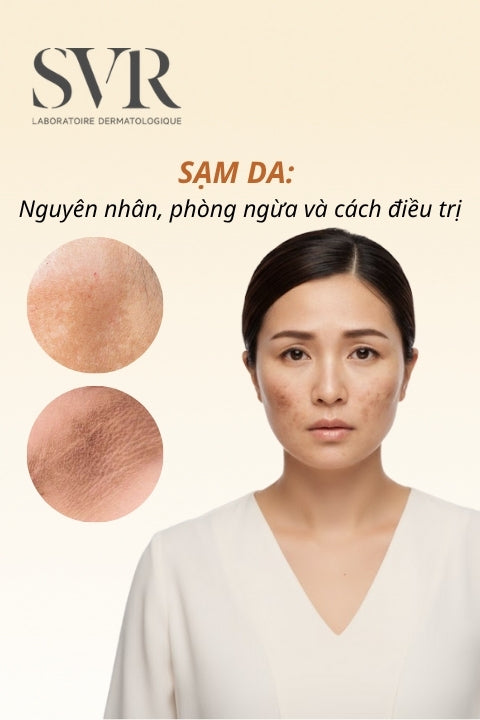 Sạm da: Nguyên nhân, phòng ngừa và cách dưỡng trắng