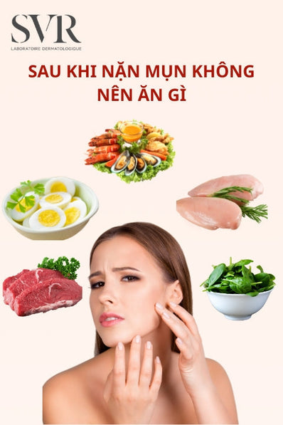 Sau khi nặn mụn không nên ăn gì để tránh viêm, và nên ăn gì để sáng da