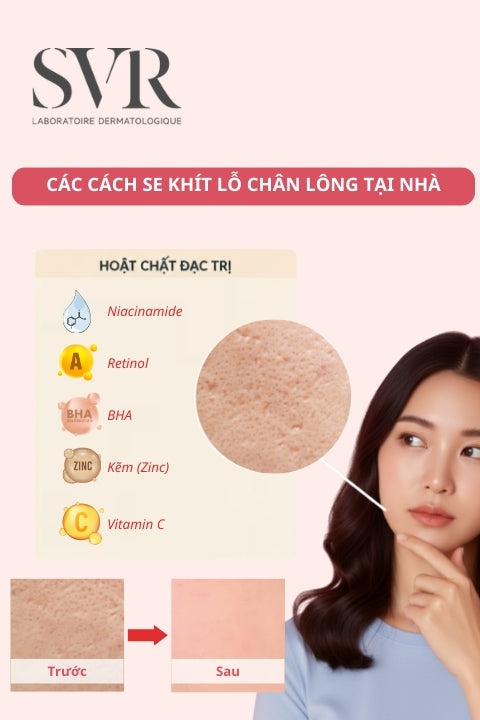 se khít lỗ chân lông tại nhà